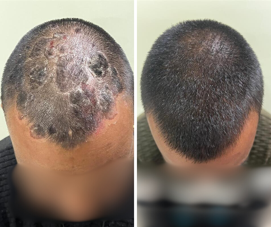 Before Hair Treatment 2